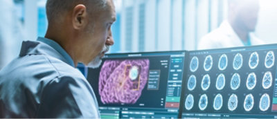 一位穿白色外套的男士看着显示脑部图像的计算机屏幕。