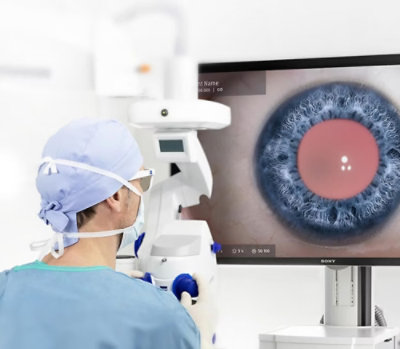 Clinician examining detailed eye imagery displayed on a medical monitor during a procedure.