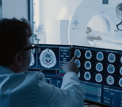Doctor looking at MRI