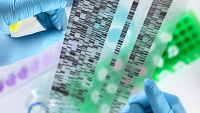 Scientist holding DNA gel in laboratory.