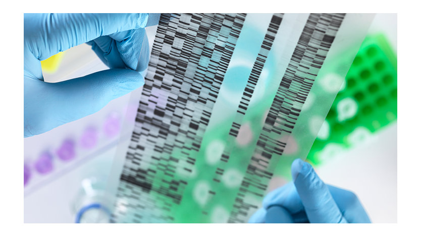 Scientist holding DNA gel in laboratory.