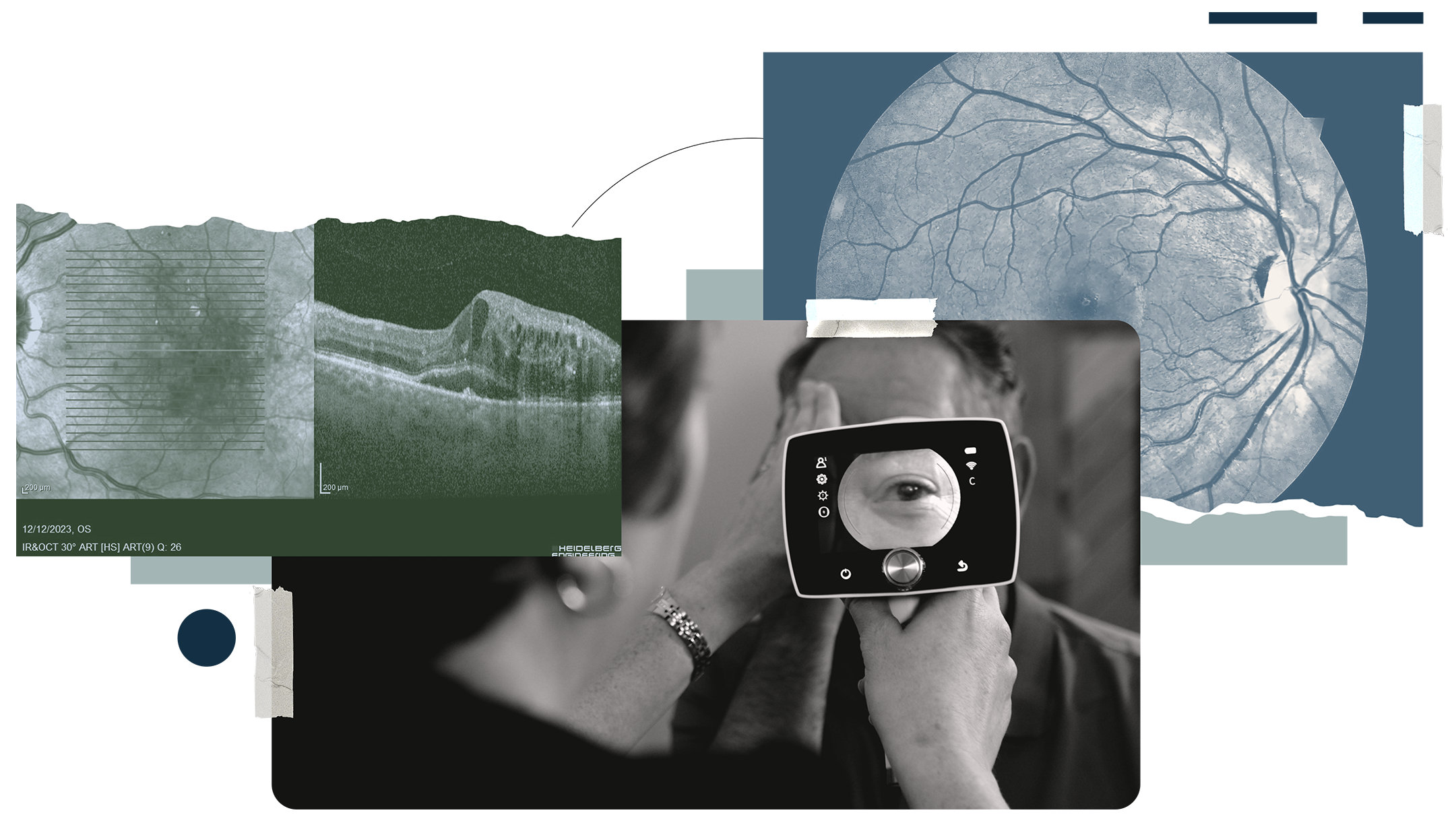 A collage of three images including a retinal image enhanced with the AI software; a healthcare worker holding a mobile imaging device in front of a patient while the device displays a magnified view of the patient’s retina; and a medical scan of retina.