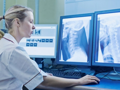 Healthcare professional using a workstation to examine X-ray images displayed on multiple screens.