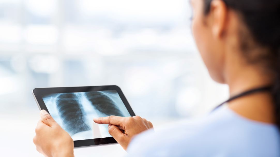 A medical professional reviewing an image scan on a Surface Pro in tablet mode
