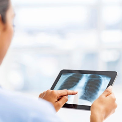 A doctor analyzing an X-ray