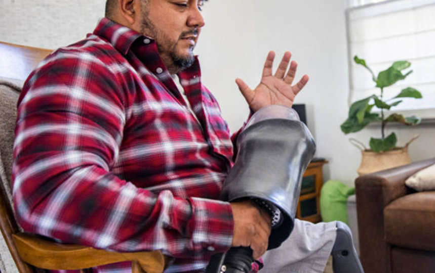 An american veteran duble amputee on a telemedicin call with his doctor at hmoe