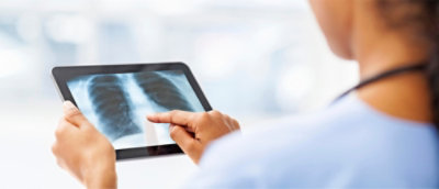 A person pointing at x-ray.