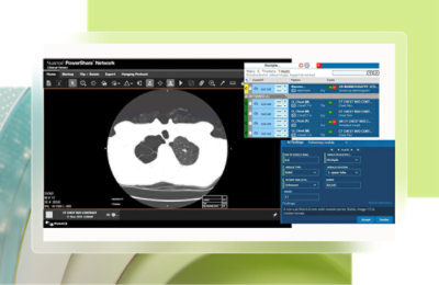 A screenshot of a screen showing Nuance PowerShare network clinical viewer.